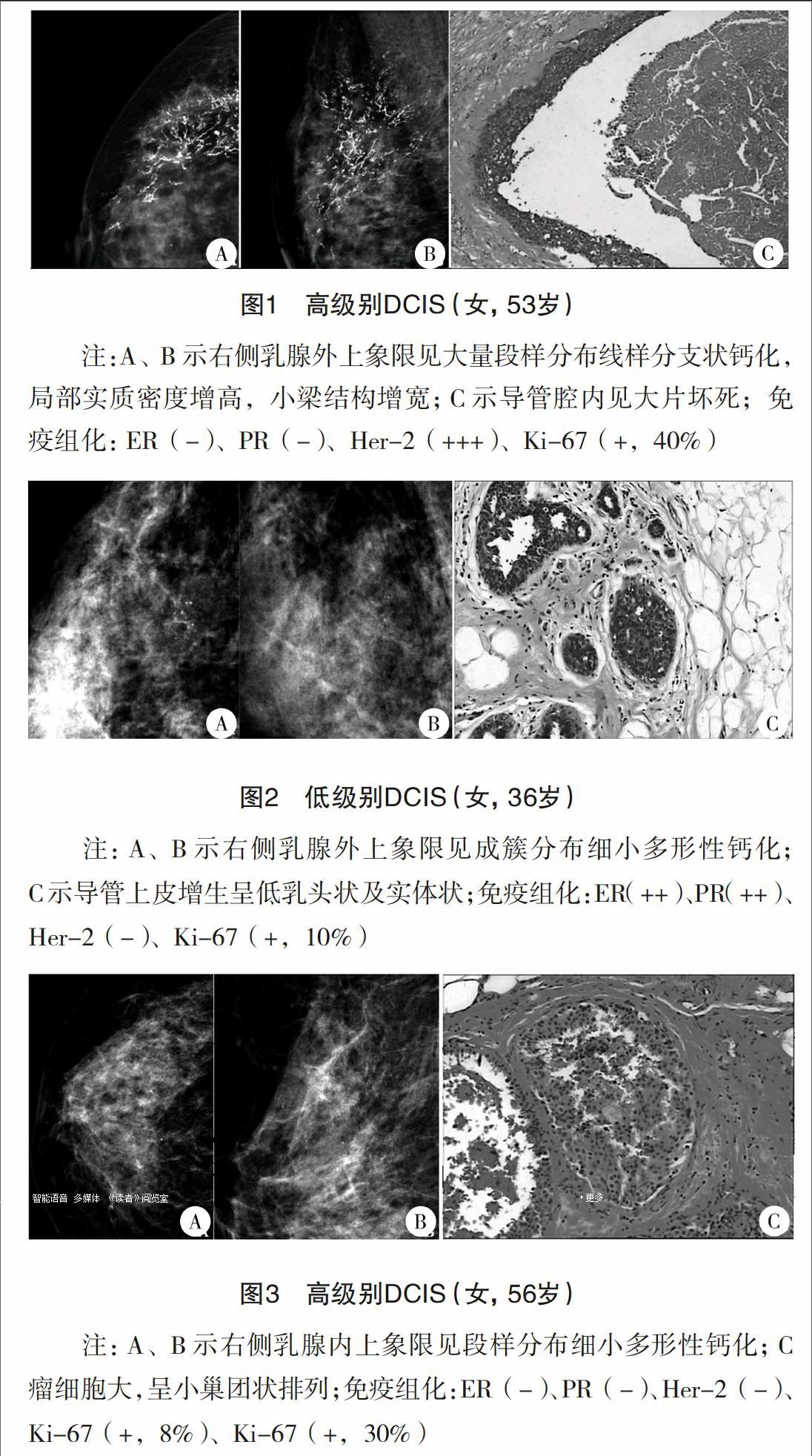 中国乳腺癌随诊随访与健康管理指南(2022版) - 癌症患者症状管理平台